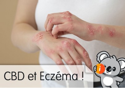 CBD pour l'eczéma : huile de chanvre, crème et baume, produit CBD contre eczéma, avis